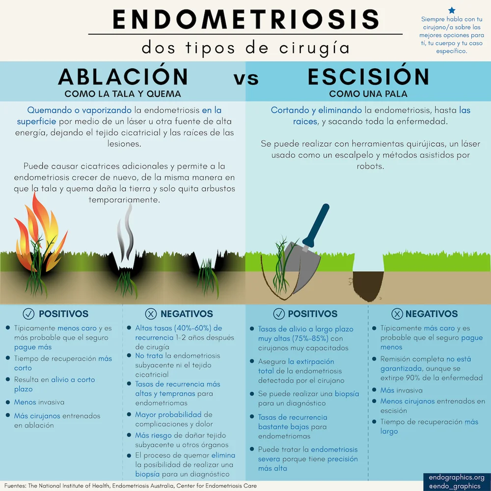 Endometriosis: dos tipos de cirugía. Infografía que compara la ablación con la escisión